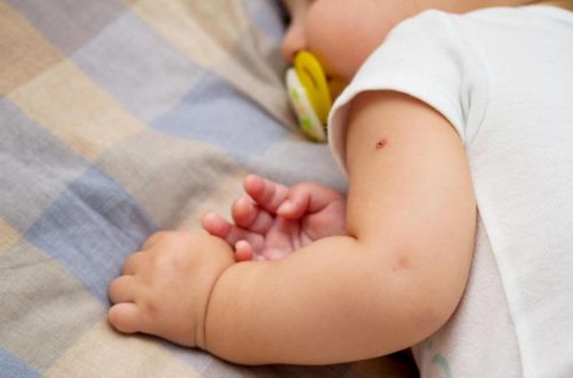 Из роддомов выписывают без БЦЖ: в Украине закончилась вакцина от туберкулёза
